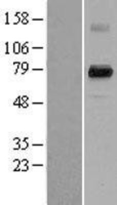 Western Blot: PAD4 Overexpression Lysate (Adult Normal) [NBL1-14061] Left-Empty vector transfected control cell lysate (HEK293 cell lysate); Right -Over-expression Lysate for PAD4.