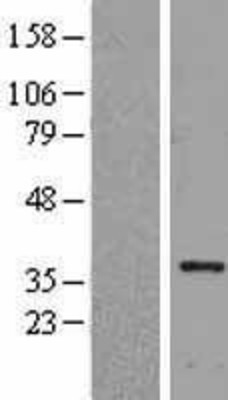 Western Blot: HLF Overexpression Lysate (Adult Normal) [NBL1-11598] Left-Empty vector transfected control cell lysate (HEK293 cell lysate); Right -Over-expression Lysate for HLF.