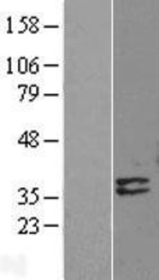 Western Blot: Deoxyribonuclease I like 1 Overexpression Lysate (Adult Normal) [NBL1-09960] Left-Empty vector transfected control cell lysate (HEK293 cell lysate); Right -Over-expression Lysate for Deoxyribonuclease I like 1.