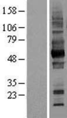 Western Blot: CD147 Overexpression Lysate (Adult Normal) [NBL1-08038] Left-Empty vector transfected control cell lysate (HEK293 cell lysate); Right -Over-expression Lysate for CD147.