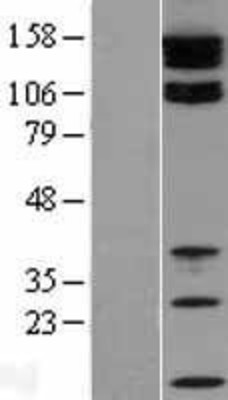Western Blot: Tight junction protein ZO-2 Overexpression Lysate (Adult Normal) [NBL1-16938] Left-Empty vector transfected control cell lysate (HEK293 cell lysate); Right -Over-expression Lysate for Tight junction protein ZO-2.