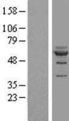 Western Blot: NOC4L Overexpression Lysate (Adult Normal) [NBL1-13704] Left-Empty vector transfected control cell lysate (HEK293 cell lysate); Right -Over-expression Lysate for NOC4L.