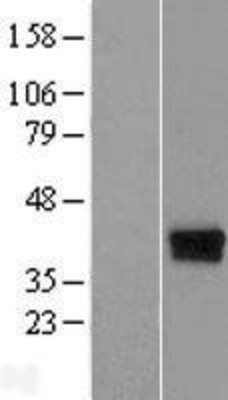 Western Blot: DERP6 Overexpression Lysate (Adult Normal) [NBL1-08247] Left-Empty vector transfected control cell lysate (HEK293 cell lysate); Right -Over-expression Lysate for DERP6.