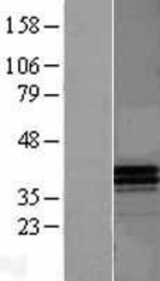 Western Blot: Apolipoprotein F Overexpression Lysate (Adult Normal) [NBL1-07622] Left-Empty vector transfected control cell lysate (HEK293 cell lysate); Right -Over-expression Lysate for Apolipoprotein F.