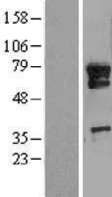 Western Blot: METTL13 Overexpression Lysate (Adult Normal) [NBL1-12256] Left-Empty vector transfected control cell lysate (HEK293 cell lysate); Right -Over-expression Lysate for METTL13.