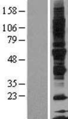 Western Blot: Glycoprotein VI Overexpression Lysate (Adult Normal) [NBL1-11211] Left-Empty vector transfected control cell lysate (HEK293 cell lysate); Right -Over-expression Lysate for Glycoprotein VI.