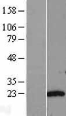 Western Blot: TAF9 Overexpression Lysate (Adult Normal) [NBL1-16689] Left-Empty vector transfected control cell lysate (HEK293 cell lysate); Right -Over-expression Lysate for TAF9.