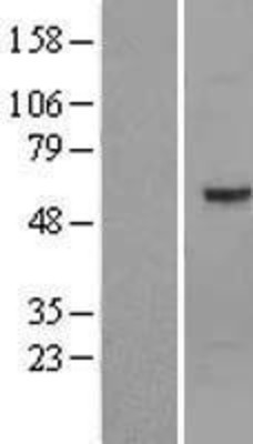 Western Blot: Optimedin Overexpression Lysate (Adult Normal) [NBL1-13927] Left-Empty vector transfected control cell lysate (HEK293 cell lysate); Right -Over-expression Lysate for Optimedin.