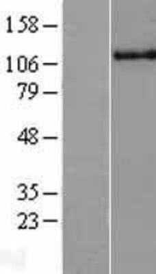 Western Blot: HLTF Overexpression Lysate (Adult Normal) [NBL1-11599] Left-Empty vector transfected control cell lysate (HEK293 cell lysate); Right -Over-expression Lysate for HLTF.