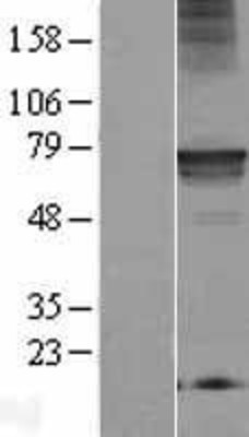 Western Blot: Mic1 Overexpression Lysate (Adult Normal) [NBL1-08259] Left-Empty vector transfected control cell lysate (HEK293 cell lysate); Right -Over-expression Lysate for Mic1.