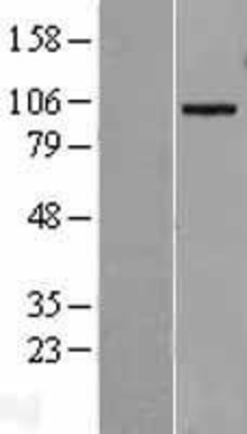 Western Blot: ADAM19 Overexpression Lysate (Adult Normal) [NBL1-07307] Left-Empty vector transfected control cell lysate (HEK293 cell lysate); Right -Over-expression Lysate for ADAM19.