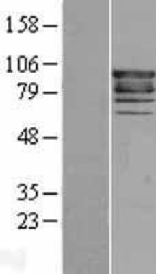 Western Blot: EPS8 Overexpression Lysate (Adult Normal) [NBL1-10303] Left-Empty vector transfected control cell lysate (HEK293 cell lysate); Right -Over-expression Lysate for EPS8.