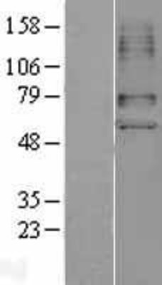 Western Blot: SLC22A6 Overexpression Lysate (Adult Normal) [NBL1-16038] Left-Empty vector transfected control cell lysate (HEK293 cell lysate); Right -Over-expression Lysate for SLC22A6.