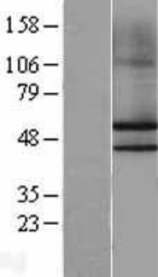 Western Blot: NKAP Overexpression Lysate (Adult Normal) [NBL1-13651] Left-Empty vector transfected control cell lysate (HEK293 cell lysate); Right -Over-expression Lysate for NKAP.