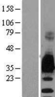 Western Blot: Myelin Protein Zero Overexpression Lysate (Adult Normal) [NBL1-13213] Left-Empty vector transfected control cell lysate (HEK293 cell lysate); Right -Over-expression Lysate for Myelin Protein Zero.