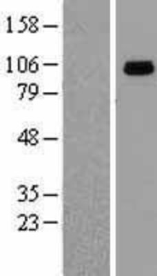 Western Blot: GRP94 Overexpression Lysate (Adult Normal) [NBL1-11746] Left-Empty vector transfected control cell lysate (HEK293 cell lysate); Right -Over-expression Lysate for GRP94.