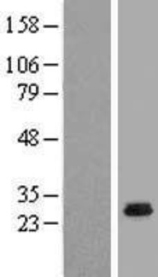 Western Blot: CCDC5 Overexpression Lysate (Adult Normal) [NBL1-08800] Left-Empty vector transfected control cell lysate (HEK293 cell lysate); Right -Over-expression Lysate for CCDC5.