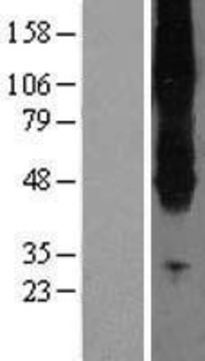 Western Blot: SLC43A2 Overexpression Lysate (Adult Normal) [NBL1-16158] Left-Empty vector transfected control cell lysate (HEK293 cell lysate); Right -Over-expression Lysate for SLC43A2.
