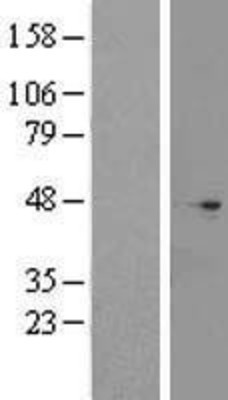 Western Blot: CNPPD1 Overexpression Lysate (Adult Normal) [NBL1-08405] Left-Empty vector transfected control cell lysate (HEK293 cell lysate); Right -Over-expression Lysate for CNPPD1.