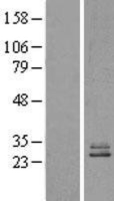 Western Blot: NDUFS3 Overexpression Lysate (Adult Normal) [NBL1-13562] Left-Empty vector transfected control cell lysate (HEK293 cell lysate); Right -Over-expression Lysate for NDUFS3.