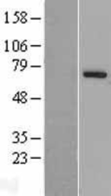 Western Blot: PARP6 Overexpression Lysate (Adult Normal) [NBL1-14118] Left-Empty vector transfected control cell lysate (HEK293 cell lysate); Right -Over-expression Lysate for PARP6.
