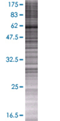 NUP85 transfected lysate.