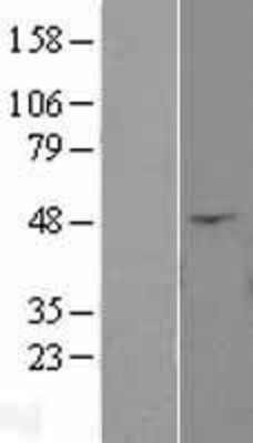 Western Blot: ANGPTL4 Overexpression Lysate (Adult Normal) [NBL1-07527] Left-Empty vector transfected control cell lysate (HEK293 cell lysate); Right -Over-expression Lysate for ANGPTL4.
