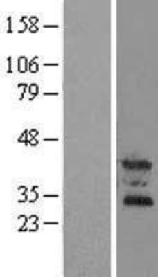 Western Blot: OSCAR Overexpression Lysate (Adult Normal) [NBL1-13998] Left-Empty vector transfected control cell lysate (HEK293 cell lysate); Right -Over-expression Lysate for OSCAR.