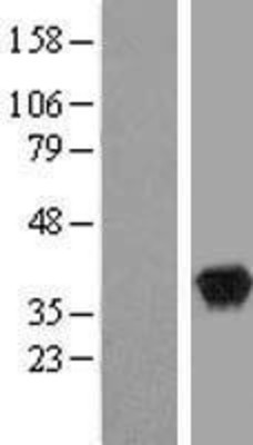 Western Blot: WDR5 Overexpression Lysate (Adult Normal) [NBL1-17817] Left-Empty vector transfected control cell lysate (HEK293 cell lysate); Right -Over-expression Lysate for WDR5.