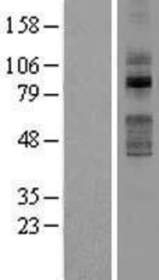 Western Blot: TLK2 Overexpression Lysate (Adult Normal) [NBL1-16948] Left-Empty vector transfected control cell lysate (HEK293 cell lysate); Right -Over-expression Lysate for TLK2.