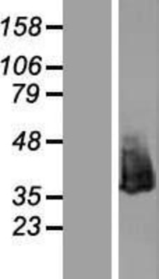 Western Blot: Nucleophosmin Overexpression Lysate (Adult Normal) [NBL1-13749] Left-Empty vector transfected control cell lysate (HEK293 cell lysate); Right -Over-expression Lysate for Nucleophosmin.