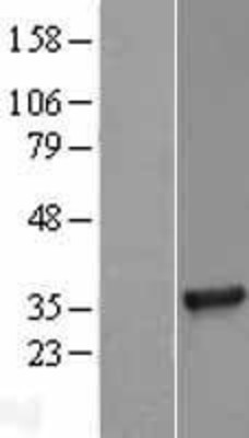 Western Blot: TICAM2 Overexpression Lysate (Adult Normal) [NBL1-16908] Left-Empty vector transfected control cell lysate (HEK293 cell lysate); Right -Over-expression Lysate for TICAM2.