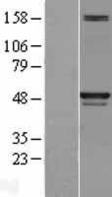 Western Blot: SKP2 Overexpression Lysate (Adult Normal) [NBL1-15995] Left-Empty vector transfected control cell lysate (HEK293 cell lysate); Right -Over-expression Lysate for SKP2.