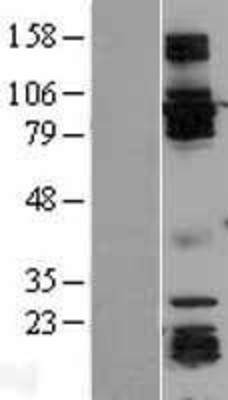 Western Blot: GRASP1 Overexpression Lysate (Adult Normal) [NBL1-11341] Left-Empty vector transfected control cell lysate (HEK293 cell lysate); Right -Over-expression Lysate for GRASP1.