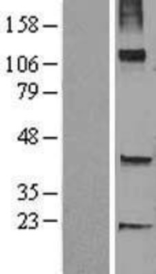 Western Blot: TRHDE Overexpression Lysate (Adult Normal) [NBL1-17268] Left-Empty vector transfected control cell lysate (HEK293 cell lysate); Right -Over-expression Lysate for TRHDE.