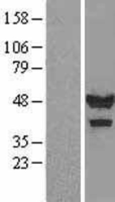 Western Blot: Calsequestrin 1 Overexpression Lysate (Adult Normal) [NBL1-08719] Left-Empty vector transfected control cell lysate (HEK293 cell lysate); Right -Over-expression Lysate for Calsequestrin 1.