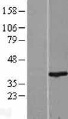 Western Blot: RNF2 Overexpression Lysate (Adult Normal) [NBL1-15442] Left-Empty vector transfected control cell lysate (HEK293 cell lysate); Right -Over-expression Lysate for RNF2.
