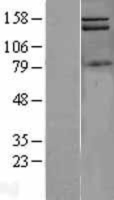 Western Blot: PIK3C2A Overexpression Lysate (Adult Normal) [NBL1-14415] Left-Empty vector transfected control cell lysate (HEK293 cell lysate); Right -Over-expression Lysate for PIK3C2A.