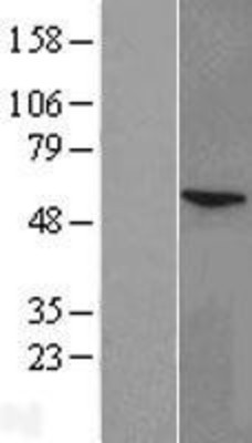 Western Blot: CYP11A1 Overexpression Lysate (Adult Normal) [NBL1-09669] Left-Empty vector transfected control cell lysate (HEK293 cell lysate); Right -Over-expression Lysate for CYP11A1.