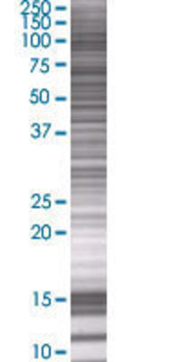 CXorf20 transfected lysate.