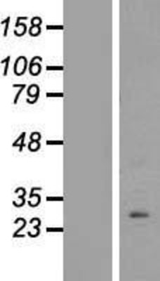 Western Blot: PPAPDC1B/DPPL1 Overexpression Lysate (Adult Normal) [NBL1-14628] Left-Empty vector transfected control cell lysate (HEK293 cell lysate); Right -Over-expression Lysate for PPAPDC1B/DPPL1.