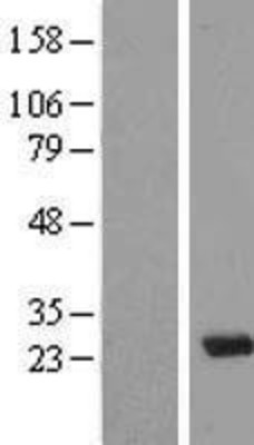 Western Blot: MAD3 Overexpression Lysate (Adult Normal) [NBL1-13407] Left-Empty vector transfected control cell lysate (HEK293 cell lysate); Right -Over-expression Lysate for MAD3.
