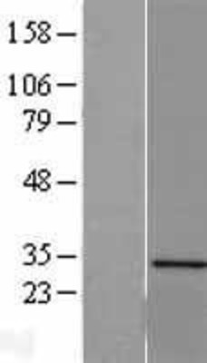 Western Blot: Sertad1 Overexpression Lysate (Adult Normal) [NBL1-15859] Left-Empty vector transfected control cell lysate (HEK293 cell lysate); Right -Over-expression Lysate for Sertad1.