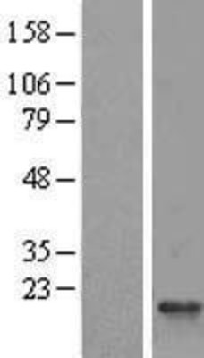 Western Blot: RPS25 Overexpression Lysate (Adult Normal) [NBL1-15567] Left-Empty vector transfected control cell lysate (HEK293 cell lysate); Right -Over-expression Lysate for RPS25.