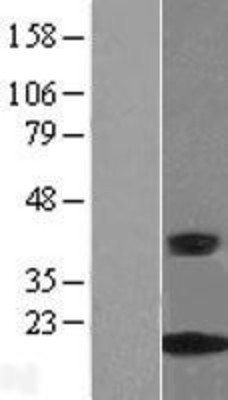 Western Blot: CRABP2 Overexpression Lysate (Adult Normal) [NBL1-09458] Left-Empty vector transfected control cell lysate (HEK293 cell lysate); Right -Over-expression Lysate for CRABP2.