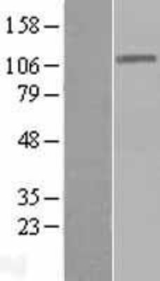 Western Blot: DIS3 Overexpression Lysate (Adult Normal) [NBL1-09892] Left-Empty vector transfected control cell lysate (HEK293 cell lysate); Right -Over-expression Lysate for DIS3.