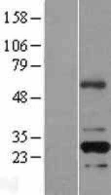 Western Blot: RFPL2 Overexpression Lysate (Adult Normal) [NBL1-15300] Left-Empty vector transfected control cell lysate (HEK293 cell lysate); Right -Over-expression Lysate for RFPL2.