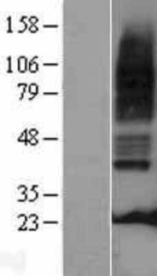 Western Blot: 5HT3A receptor Overexpression Lysate (Adult Normal) [NBL1-11779] Left-Empty vector transfected control cell lysate (HEK293 cell lysate); Right -Over-expression Lysate for 5HT3A receptor.