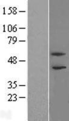 Western Blot: PHF21B Overexpression Lysate (Adult Normal) [NBL1-14358] Left-Empty vector transfected control cell lysate (HEK293 cell lysate); Right -Over-expression Lysate for PHF21B.
