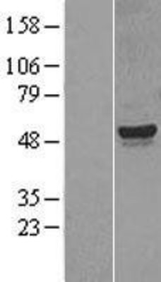 Western Blot: CYP26A1 Overexpression Lysate (Adult Normal) [NBL1-09679] Left-Empty vector transfected control cell lysate (HEK293 cell lysate); Right -Over-expression Lysate for CYP26A1.
